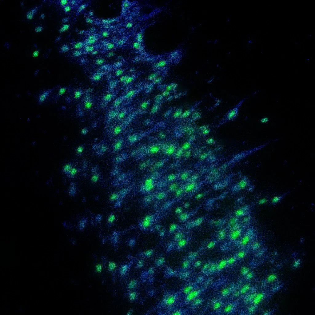 Neuronal Tracing
