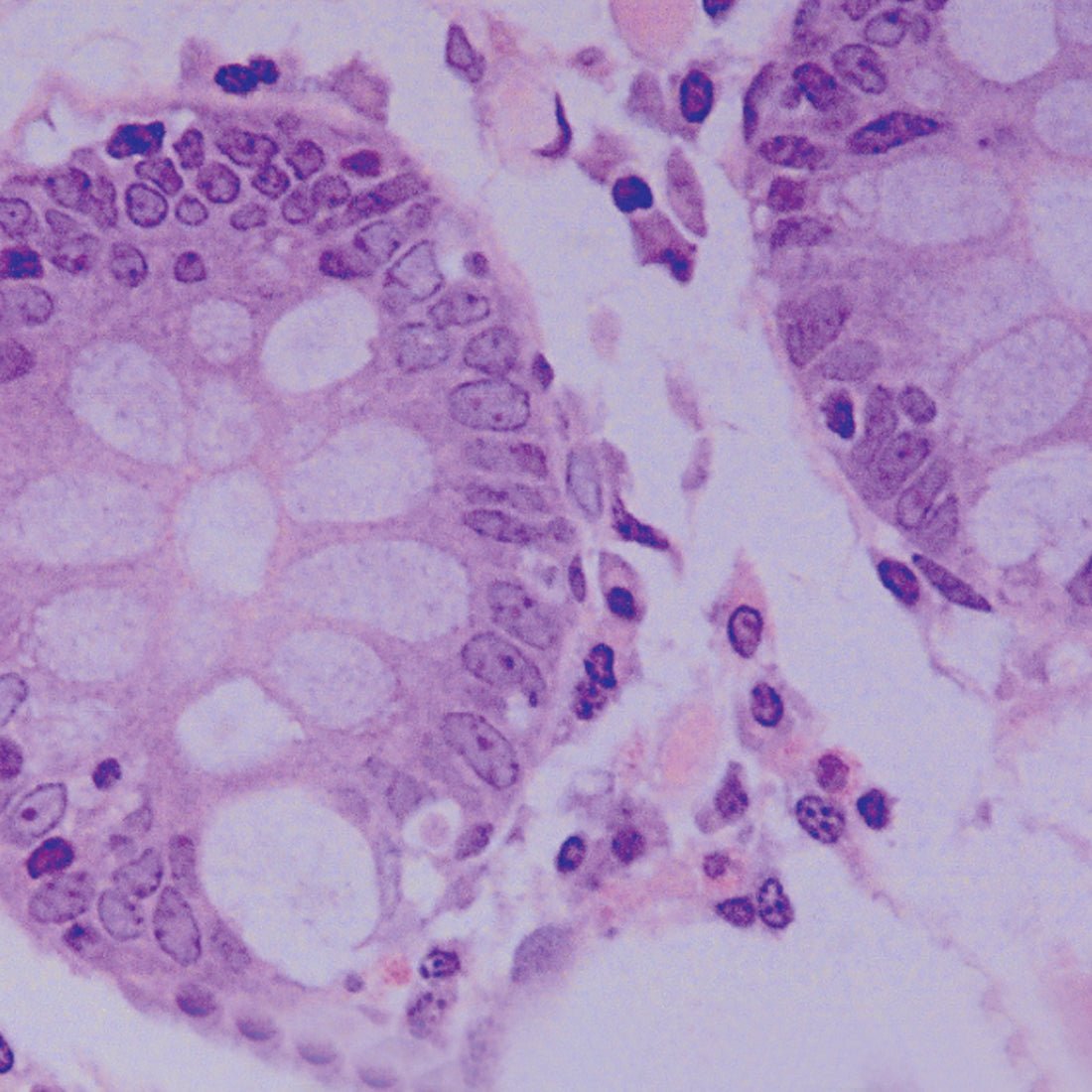 JB - 4® Embedding Kit - Polysciences