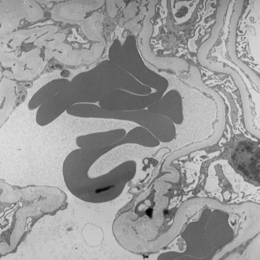 Spurr Low Viscosity Embedding Kit