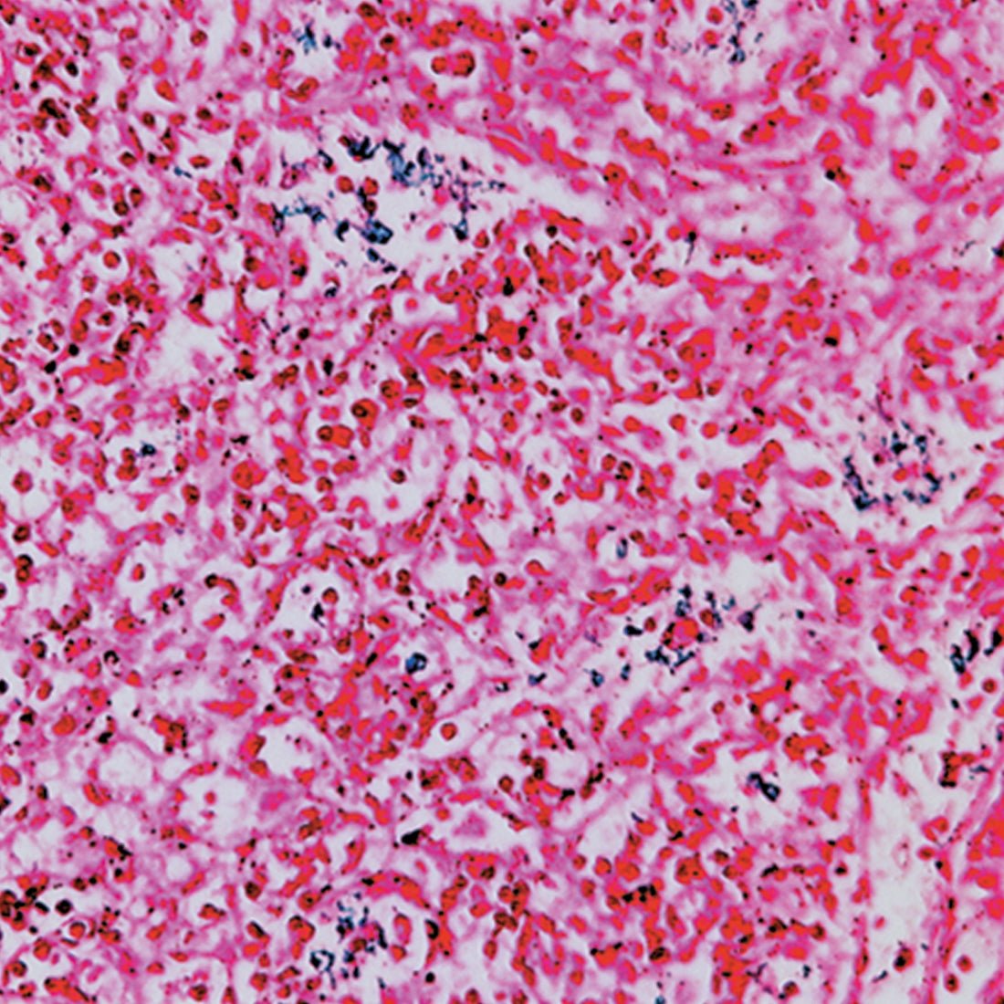 Nuclear Fast Red, 1% Solution - Polysciences