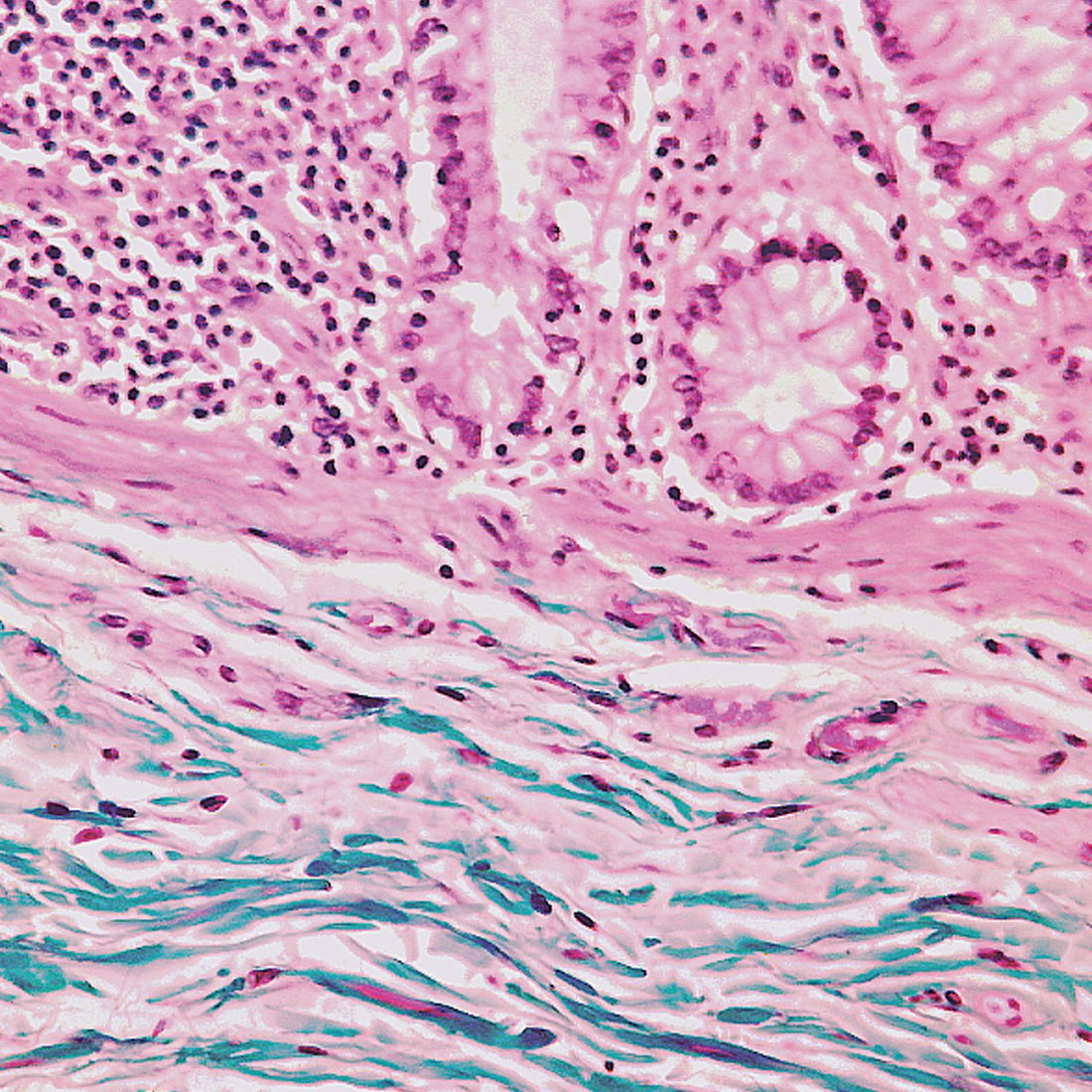 Gomori's Trichrome Stain Kit - Polysciences