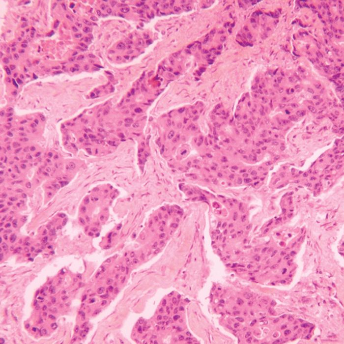 Gill's Hematoxylin #2, double strength for Histology & Cytology - Polysciences