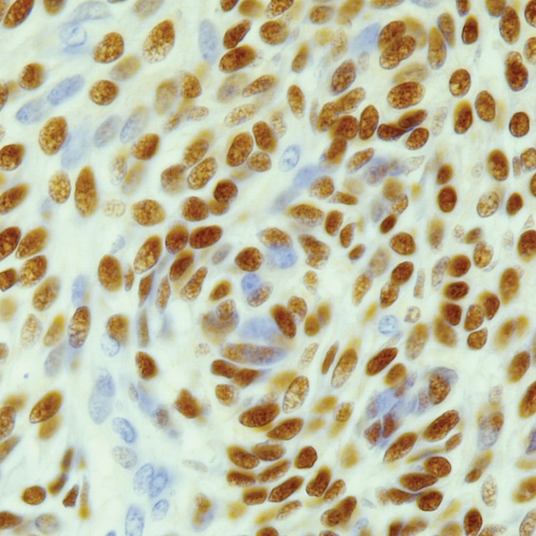 L.A.B. Solution (Liberate Antibody Binding Solution) - Polysciences