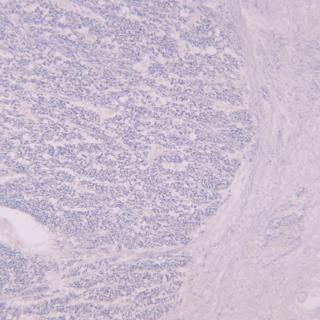 Luxol Fast Blue, Ready - to - Use - Polysciences