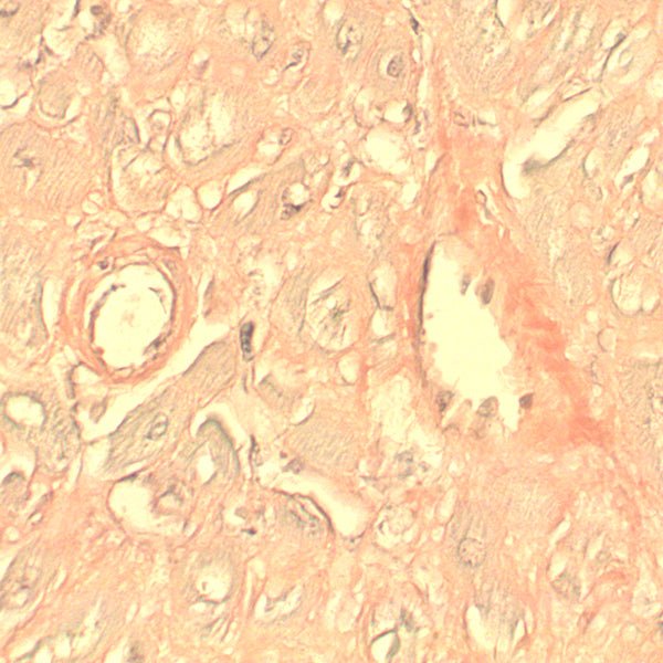 Amyloid Stain Kit (Congo Red) - Polysciences