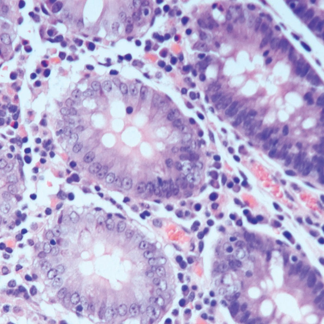 Lithium Blue - Polysciences