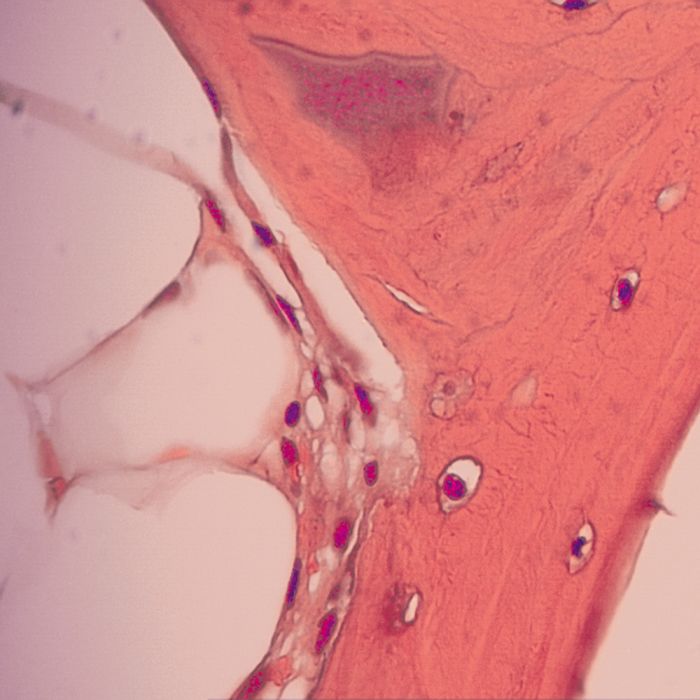 Super Decalcifier II: Heavy Duty - Polysciences