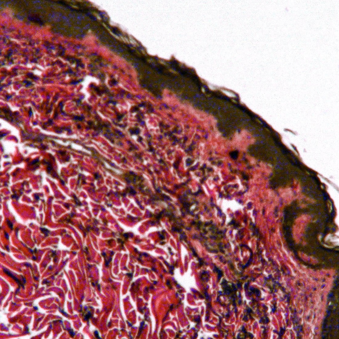 Verhoeff Van Gieson Elastin Stain Kit - Polysciences