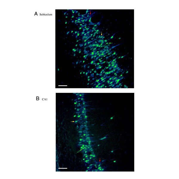 True Blue (TB) Diaceturate Salt - Polysciences
