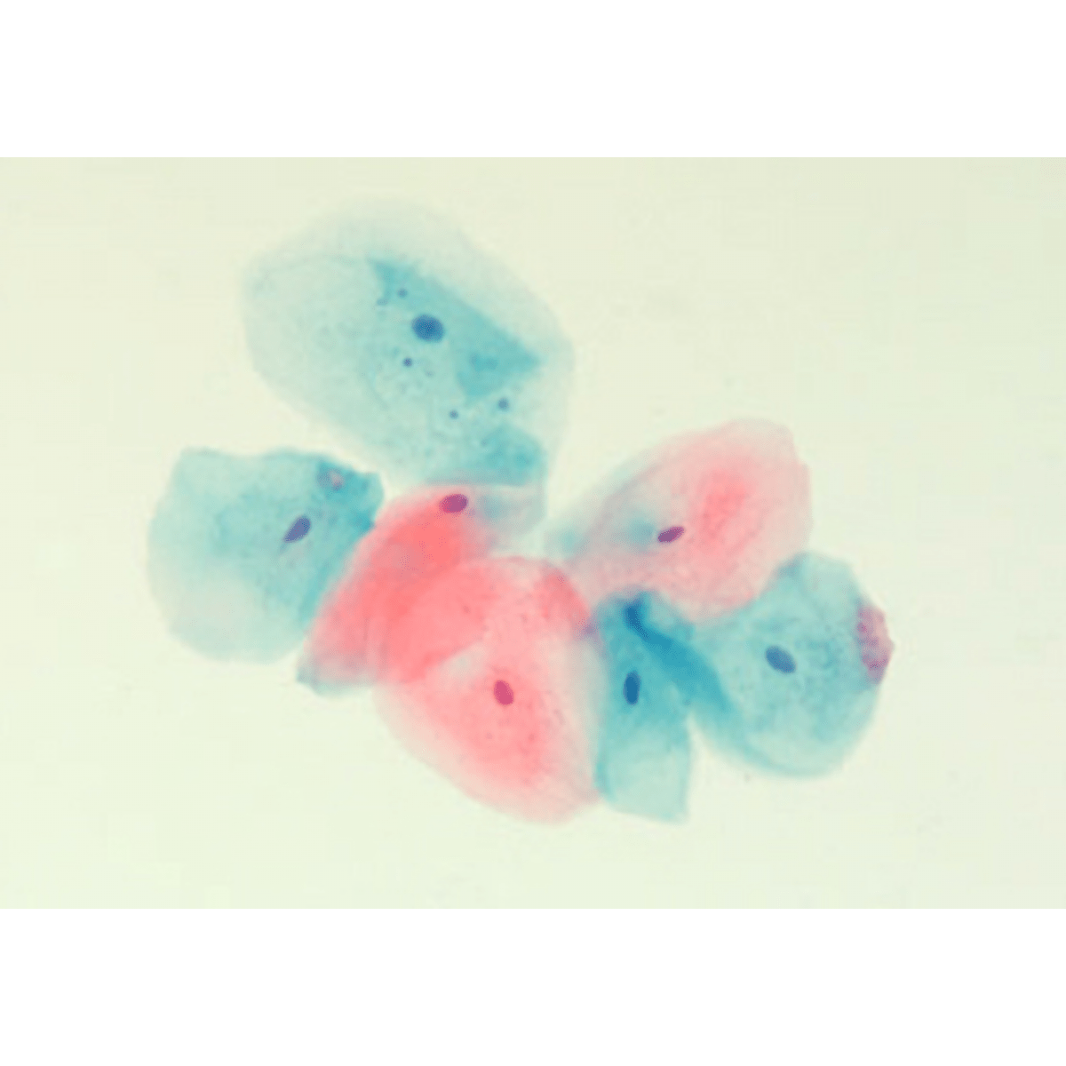 Gill's modified OG - 6 - Polysciences