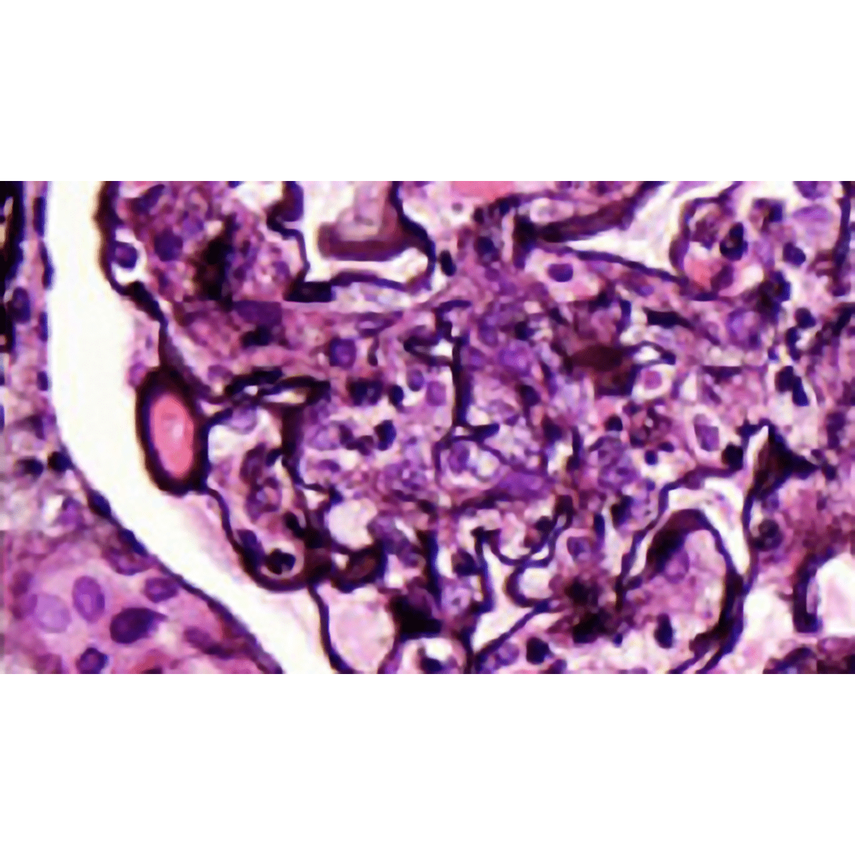 Jones PAS - M Stain Kit - Polysciences