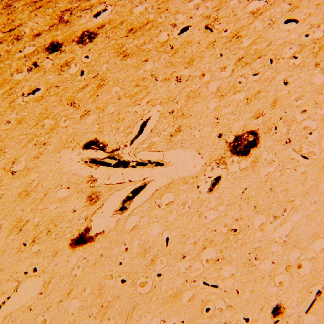 Bielschowsky Stain Kit - Polysciences