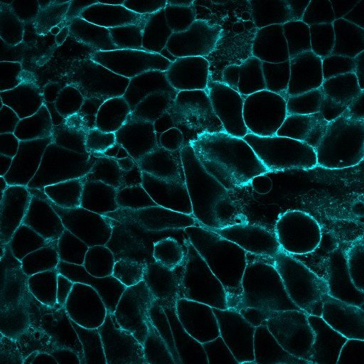 Fluorescence microscopy image showing cell membranes labeled with bright cyan fluorescent dye, representing membrane labeling techniques for cellular imaging and analysis.