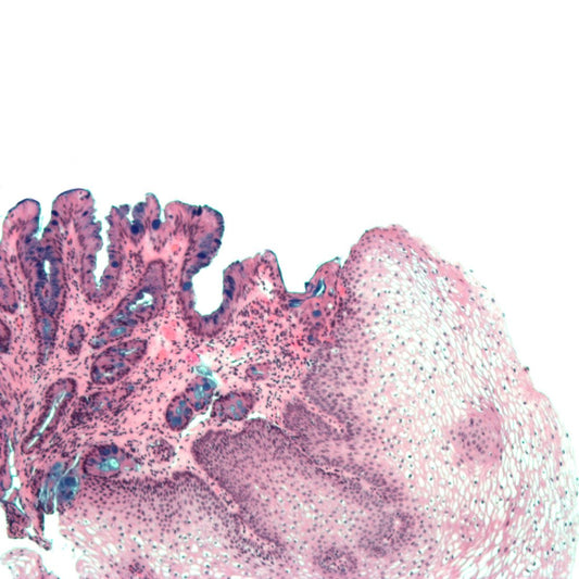 Alcian Blue 8GX, C.I. 74240 - Polysciences