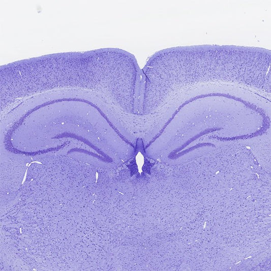 Cresyl violet acetate, certified - Polysciences