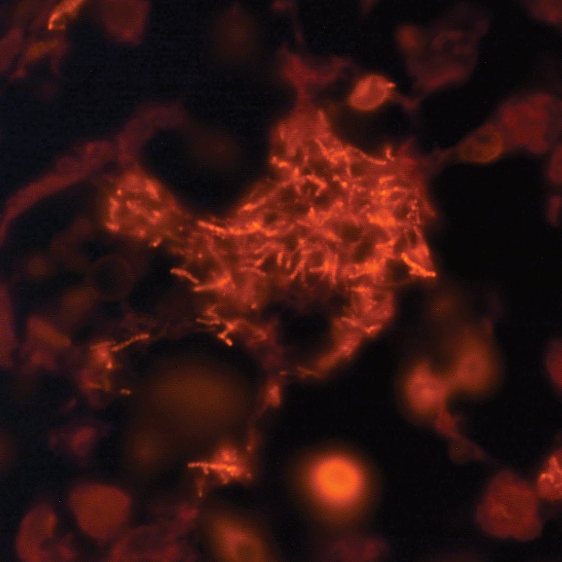 TB Fluorostain Kit - Polysciences