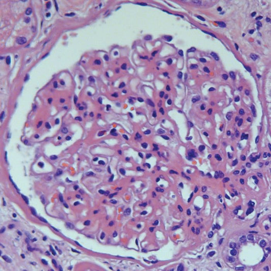 Gill's Hematoxylin #3, triple strength for Histology - Polysciences