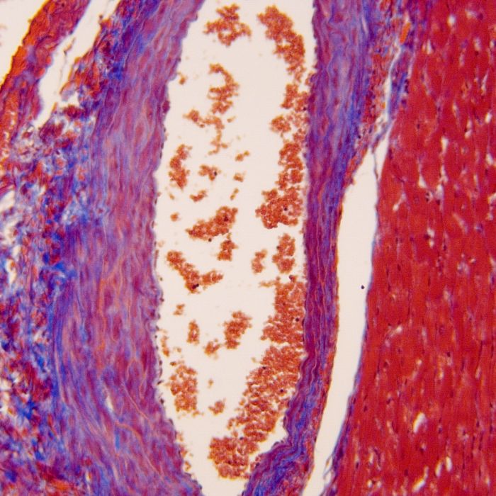Masson's Trichrome Stain Kit - Polysciences