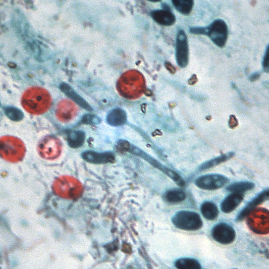AFB Kinyoun Kit (Cold Method) - Polysciences