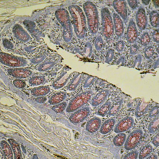 Mucicarmine Stain Kit - Polysciences